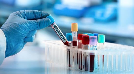 Labs and Diagnostics